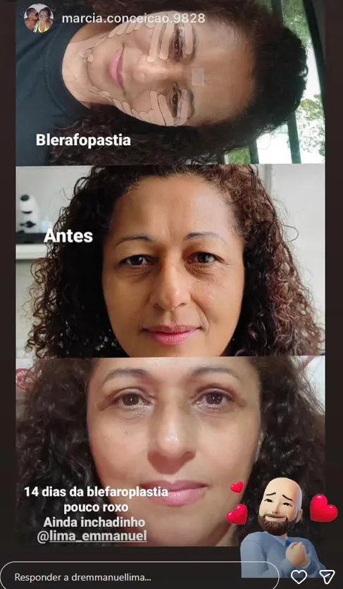 Depoimento de paciente do Dr. Emmanuel Lima