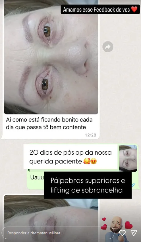 Depoimento de paciente do Dr. Emmanuel Lima