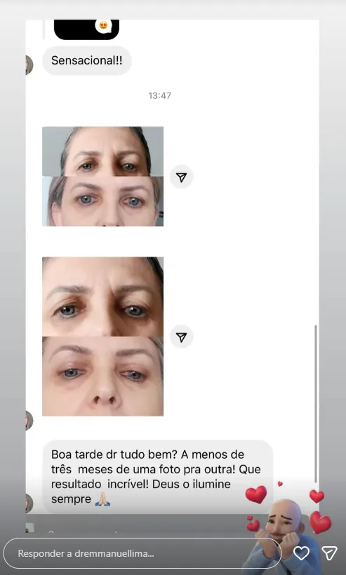 Depoimento de paciente do Dr. Emmanuel Lima