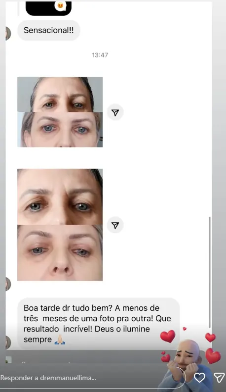 Depoimento de paciente do Dr. Emmanuel Lima